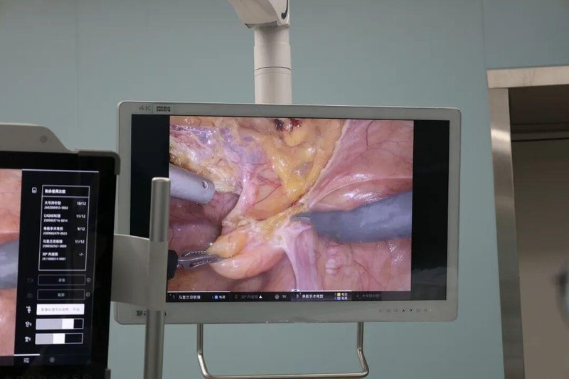  在“家门口”把病治好：一个大理患者的就医故事 健康养生